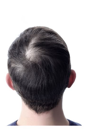 Before - Vikram Soni