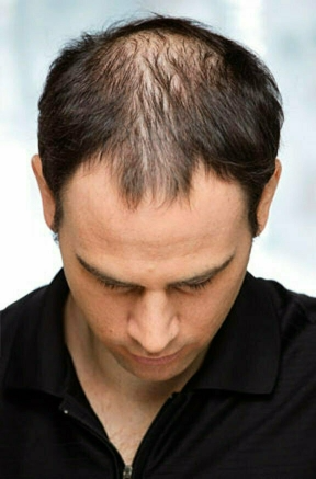 Before - Suresh Patel