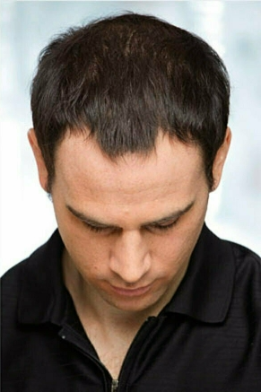 After - Suresh Patel